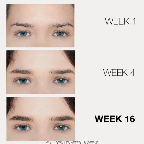 ZI'OR Eyebrow Growth Serum - Achieve Thicker, Darker, and More Defined Brows in Just 25 Days! - Image 3